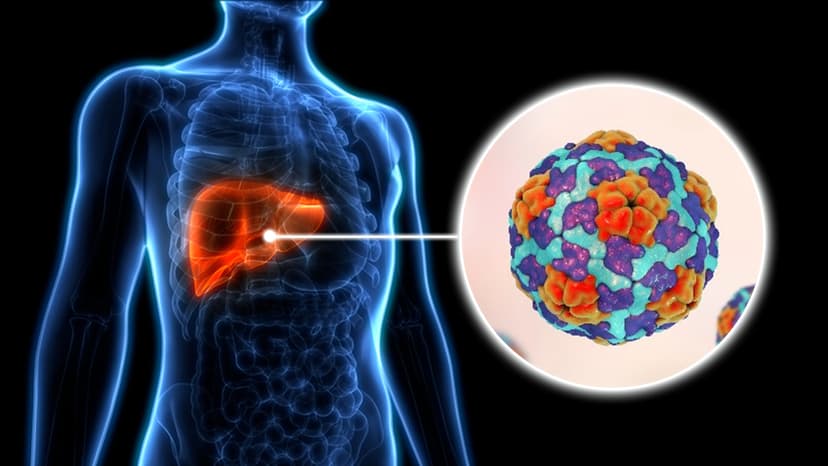 Viral Hepatitis Treatment in Turkey - Best Clinics & Treatments