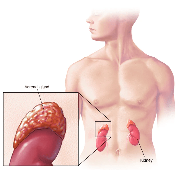 Adrenal Cancer medical condition