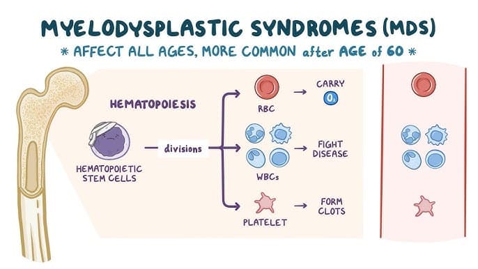 Myelodysplastic Syndromes (MDS) medical condition