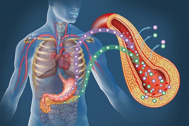 Treatment of Type 2 Diabetes in Turkey (Permanent Solution)