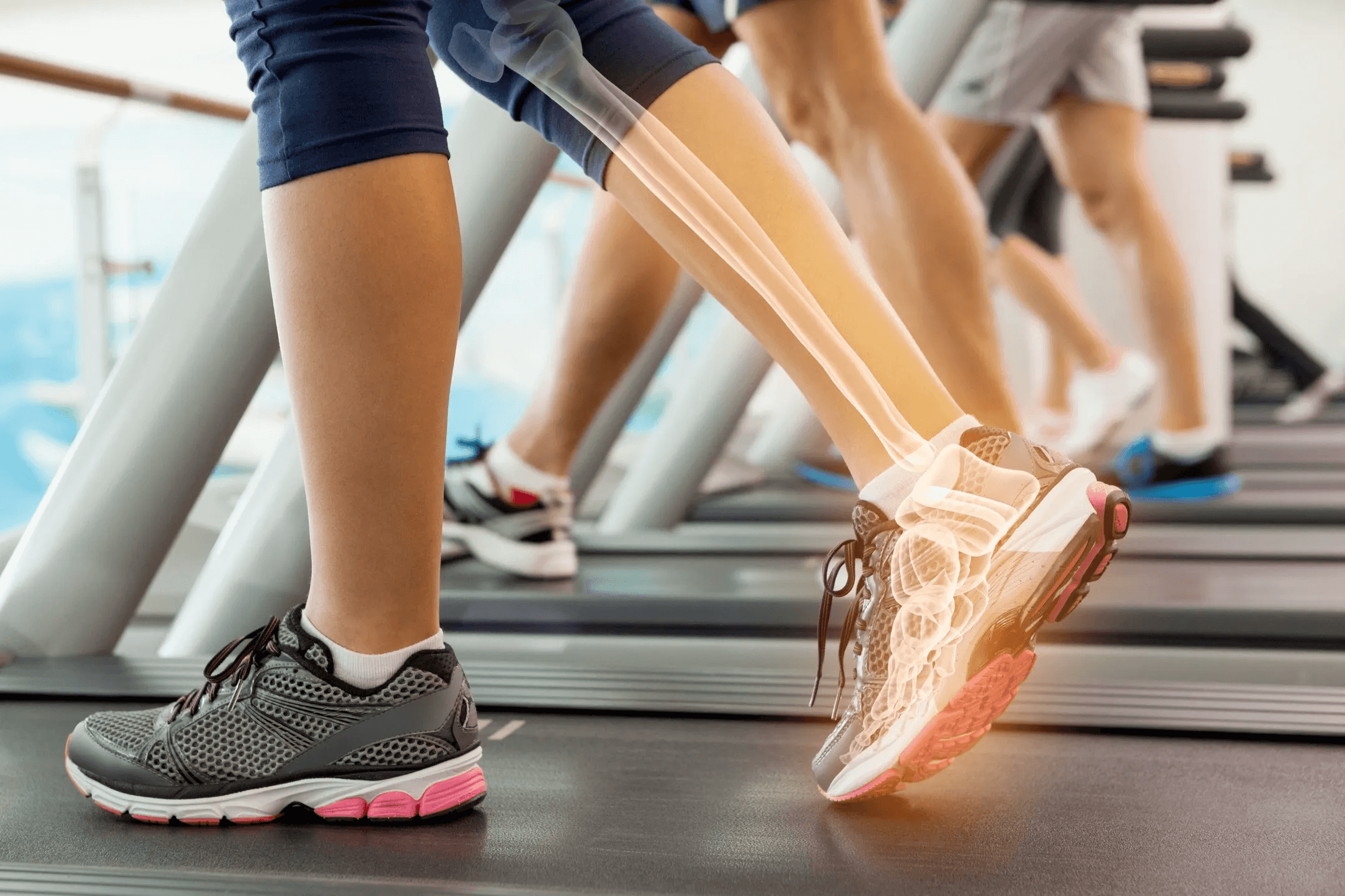Best Countries and Hospitals for Ankle Fusion Surgery Abroad