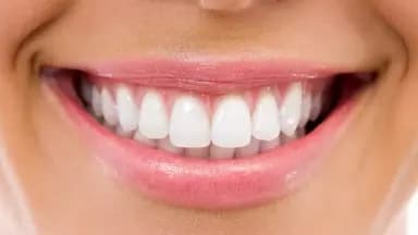 Best & Cheapest Countries for All-on-4 Dental Implants Abroad