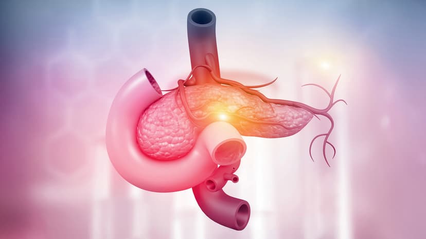 Stage 4 Pancreatic Cancer Treatment Options