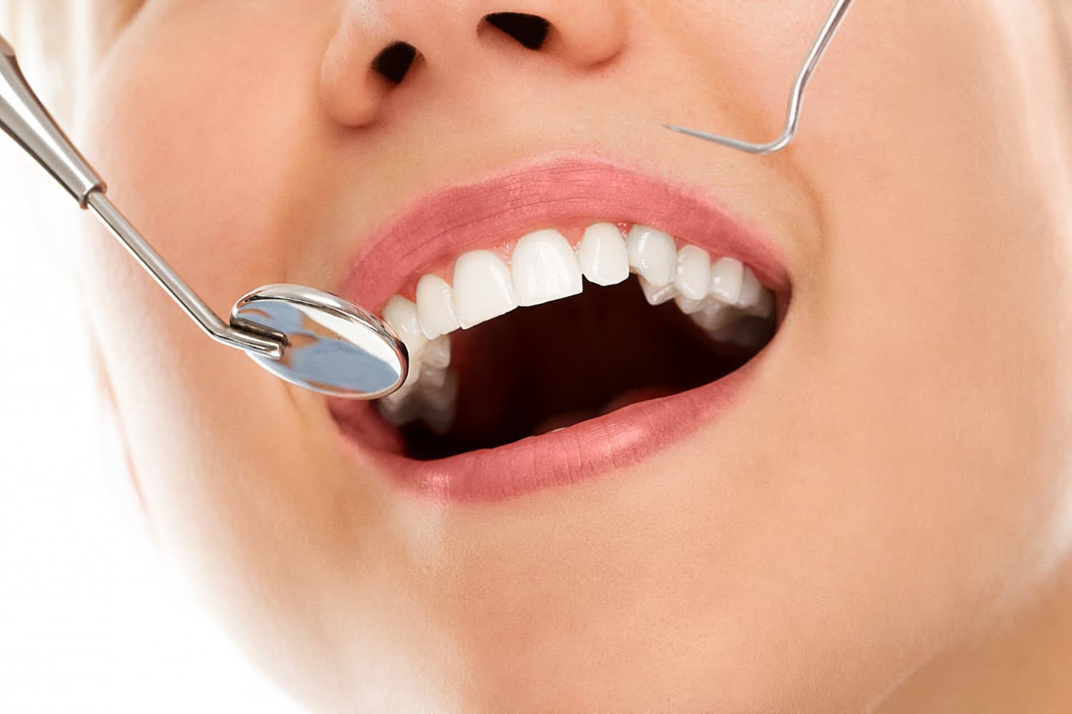 Full Mouth Dental Implants Turkey Package Deals
