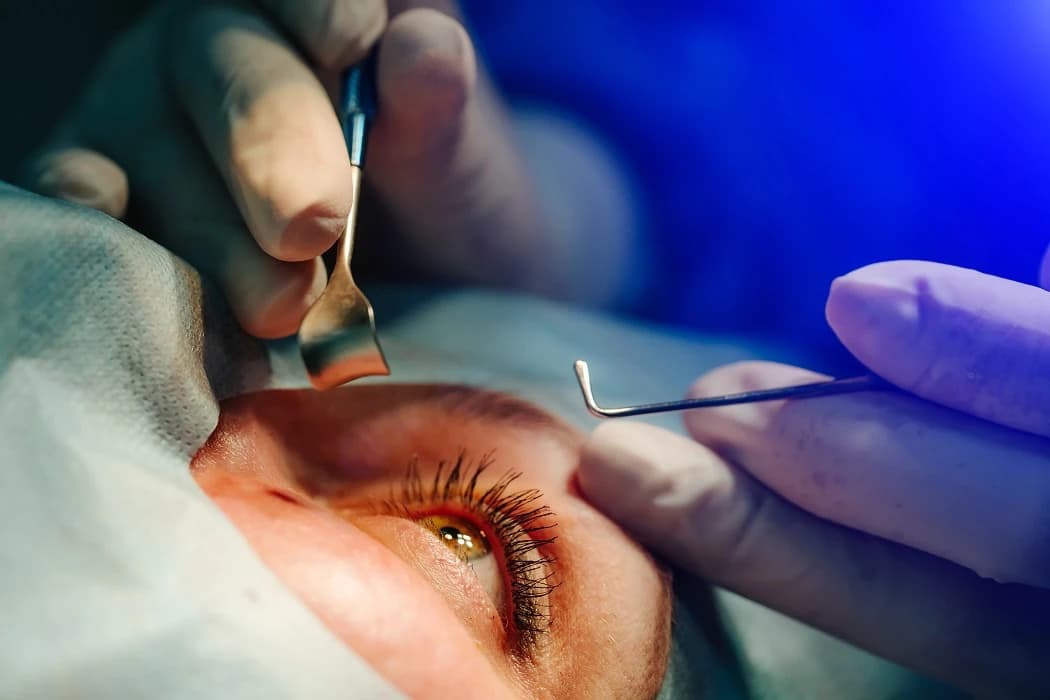 Best and Cheapest Countries for Cataract Surgery Abroad