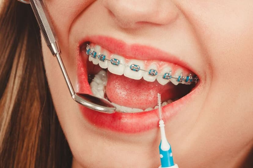 Dental Treatment in Turkey