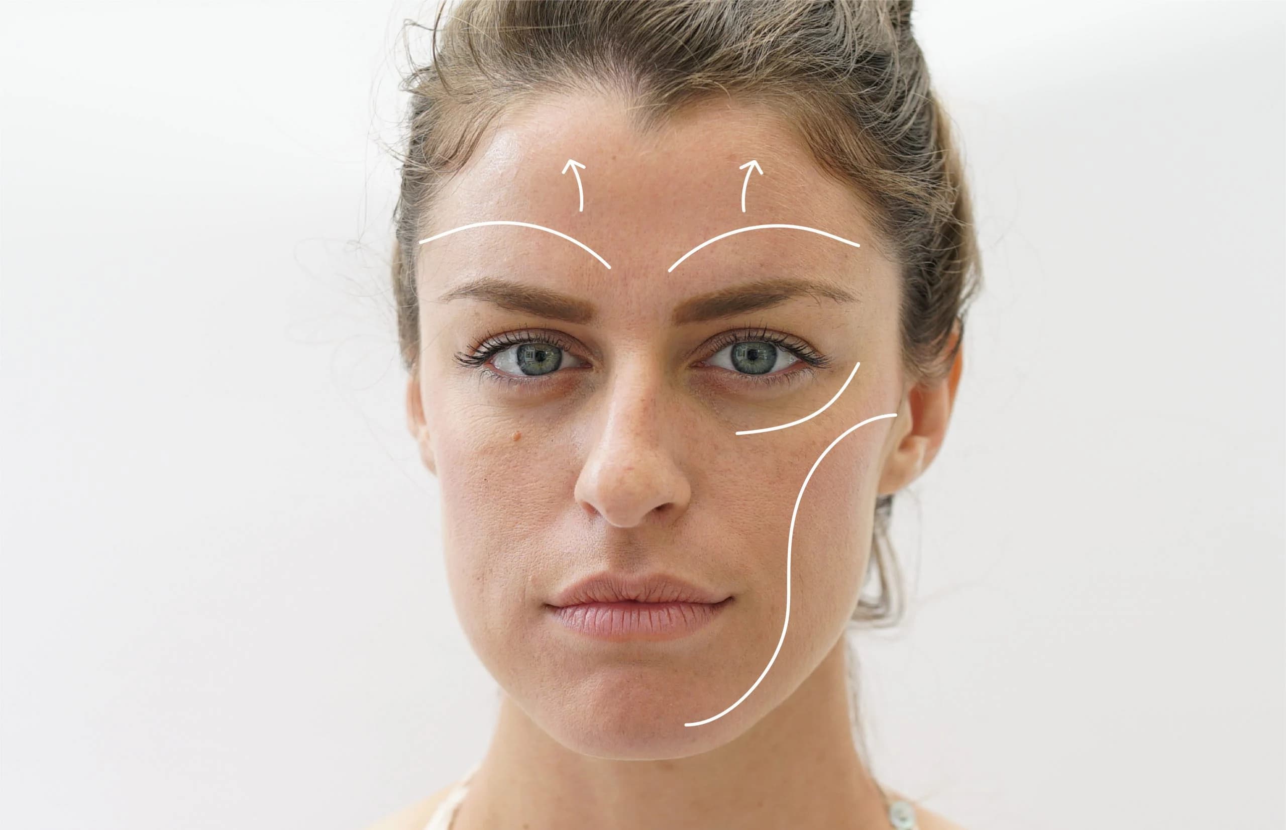 Facelift in Turkey