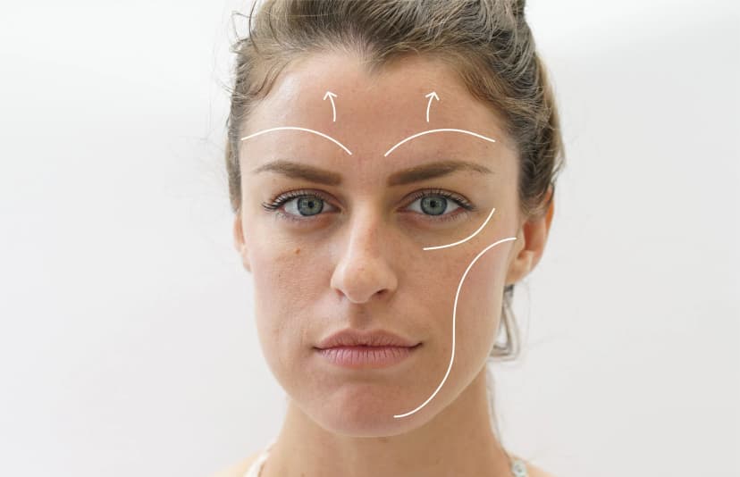 Facelift in Turkey