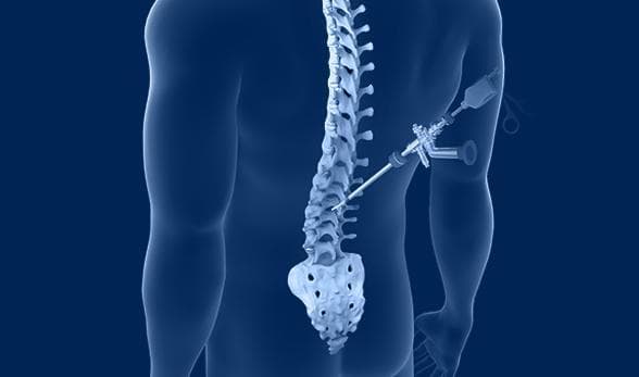 Best and Cheapest Countries for Spine Surgery Abroad