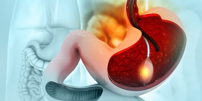 Gastric Balloon In Turkey: Guaranteed Results & 2026 Costs