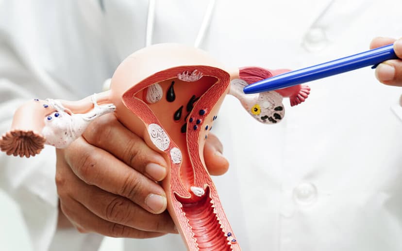 Cervical Cancer Treatment in Turkey