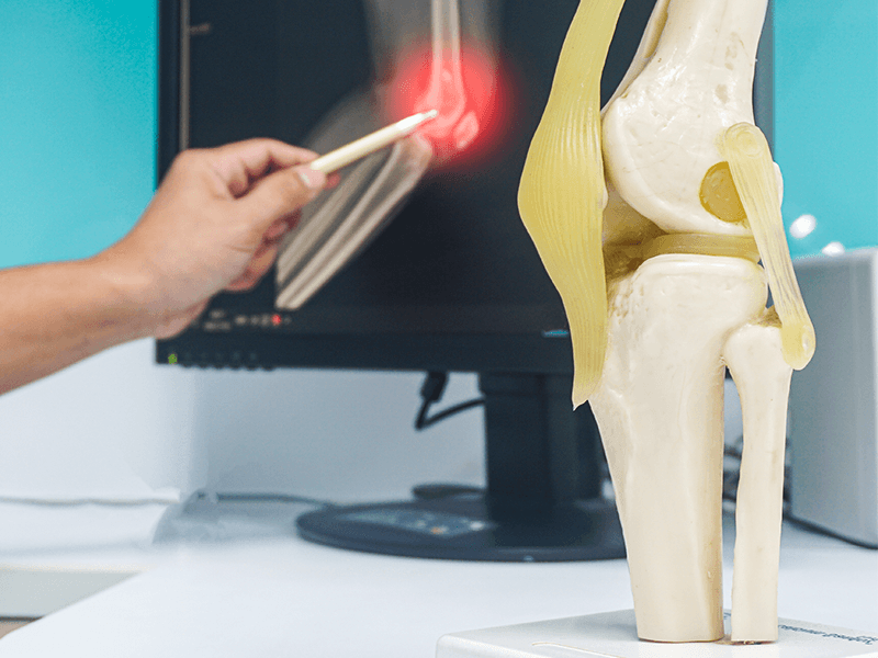 Orthopedic Surgery in Turkey