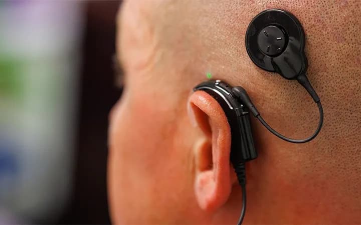Best and Cheapest Countries for Cochlear Implant Abroad