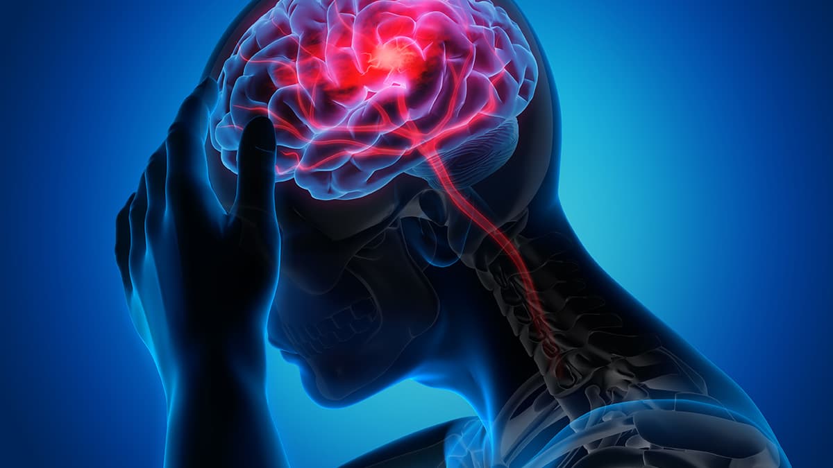 Stroke Treatment in Turkey