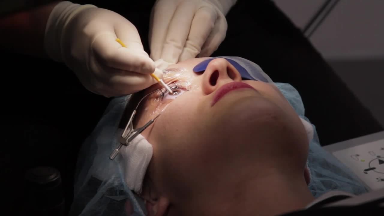 PRK Eye Surgery in Turkey