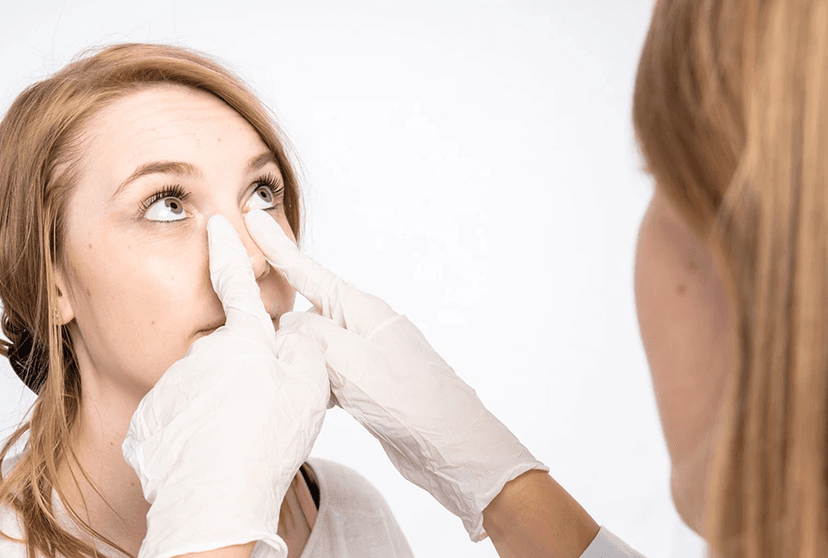 Preservation Rhinoplasty in Turkey
