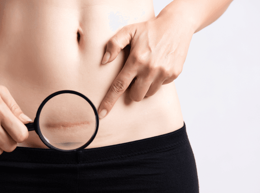 How Much Does a Gastric Bypass Surgery Cost?