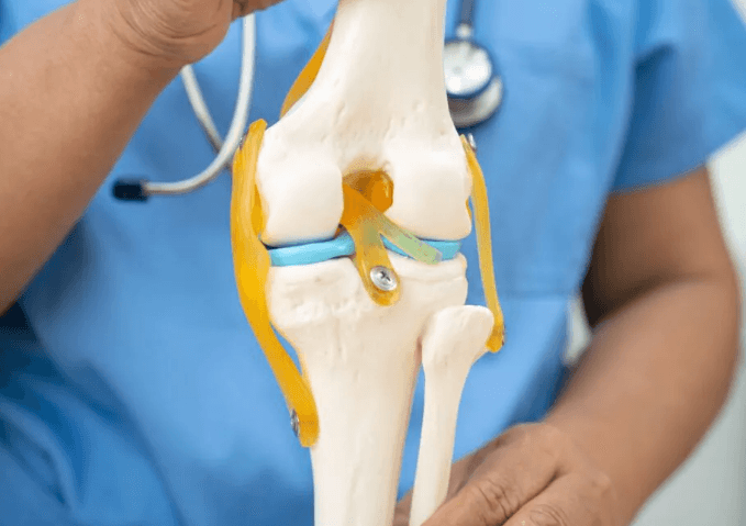 How Much Does a Knee Replacement Cost?