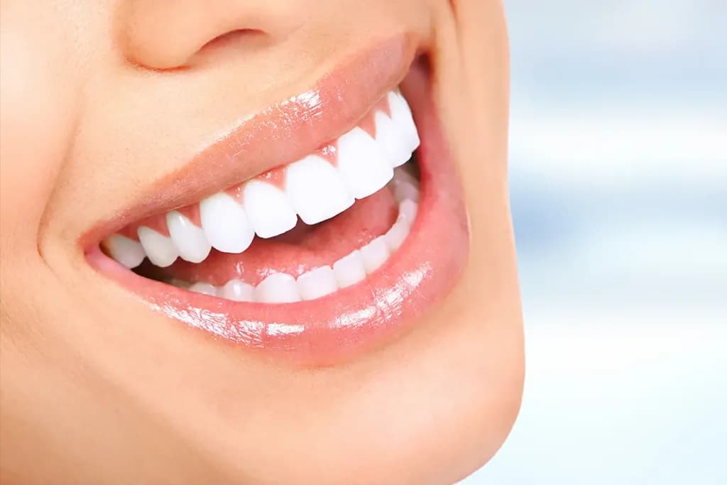 Hollywood Smile in Turkey