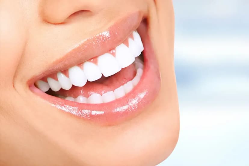 Hollywood Smile in Turkey