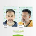 Clinichair - Before/After 3