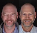 Bagcilar Dental Clinic - Before/After 1