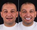 Bagcilar Dental Clinic - Before/After 3