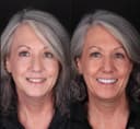 Bagcilar Dental Clinic - Before/After 2