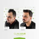 Clinichair - Before/After 1