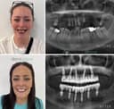Dent Glow Clinic - Before/After 4