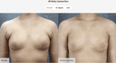 JK Plastic Surgery Center - Before/After 2