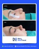 LOR Hospital - Before/After 3