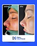 LOR Hospital - Before/After 2