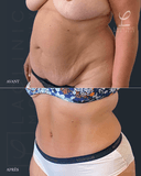 La Clinic - Before/After 1