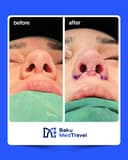 LOR Hospital - Before/After 4