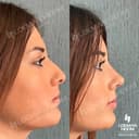 Lokman Hekim Health Group - Before/After 1