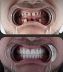 Özel Abat Medical Center - Before/After 1