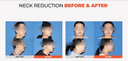 Shinsang Plastic Surgery Clinic - Before/After 3