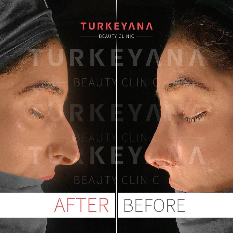 Before/After image 1