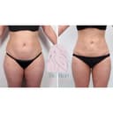 Dr. Med Clinic - Before/After 4
