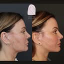 Dr. Med Clinic - Before/After 3