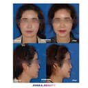 Shinsang Plastic Surgery Clinic - Before/After 1