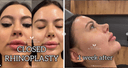 Dr. Yavuz Ozsular's Private Practice - Before/After 3