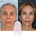Dr. Med Clinic - Before/After 1