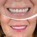 ROC Policlinic Antalya - Before/After 3