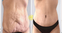 Dr. Yavuz Ozsular's Private Practice - Before/After 4