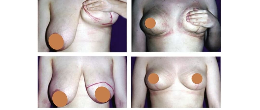 Before/After image 1