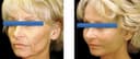 Dr. Çağrı Sade Plastic Surgery Center - Before/After 3