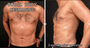 Dr. Yavuz Ozsular's Private Practice - Before/After 2