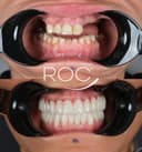 ROC Policlinic Antalya - Before/After 4